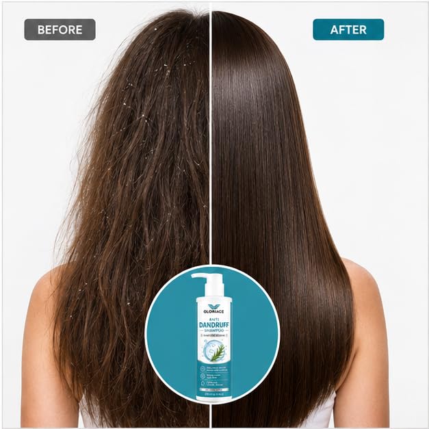 Gloriace Anti Dandruff Shampoo, for Itchy Flaky and Stubborn Scalp, with Pyrithione Zinc, All Hair Types, 200 ml
