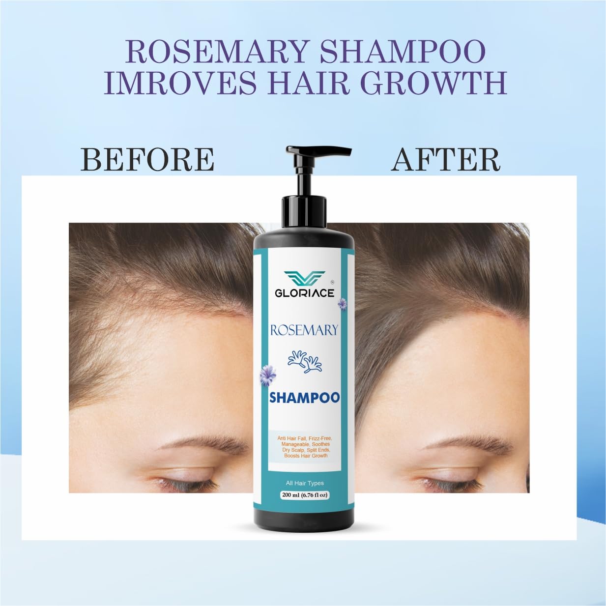 Gloriace Rosemary Hair Growth Shampoo, Anti Hair Fall, Frizz-Free, All Hair Types, 200 ml