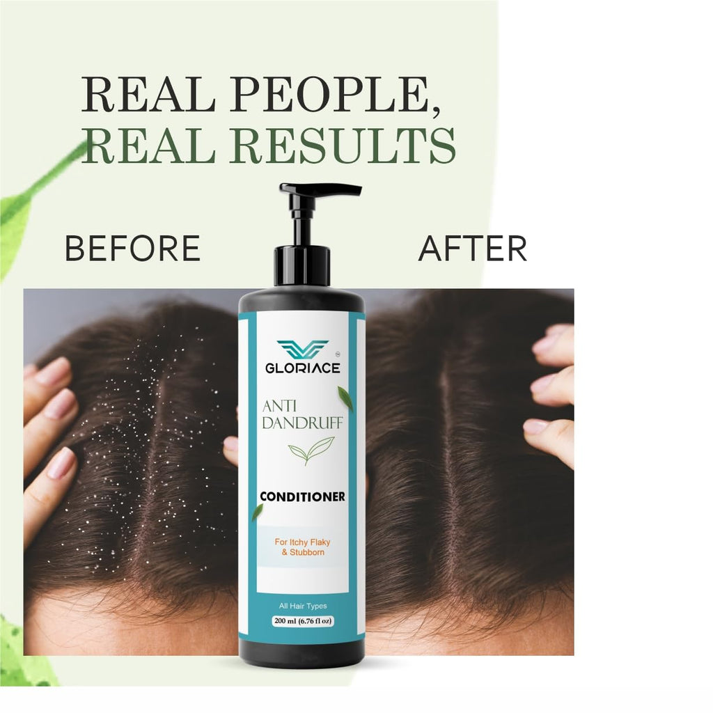 Gloriace Anti Dandruff Conditioner with Rice Water, for Itchy Flaky and Stubborn Dandruff, All Hair Types, 200 ml