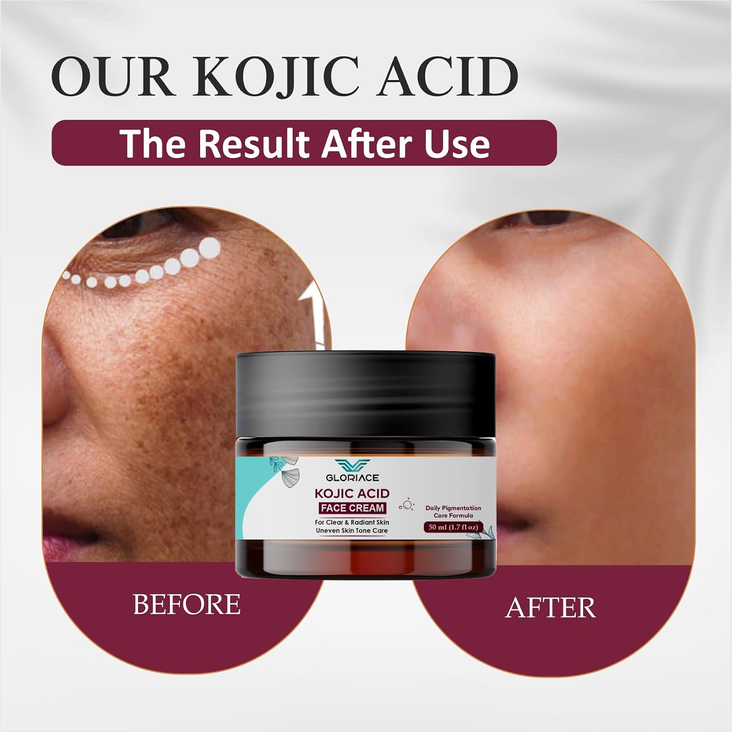 Gloriace Kojic Face Cream, Daily Pigmentation Care Formula, Clear & Radiant Skin, Uneven Skin Tone Care, 50ml
