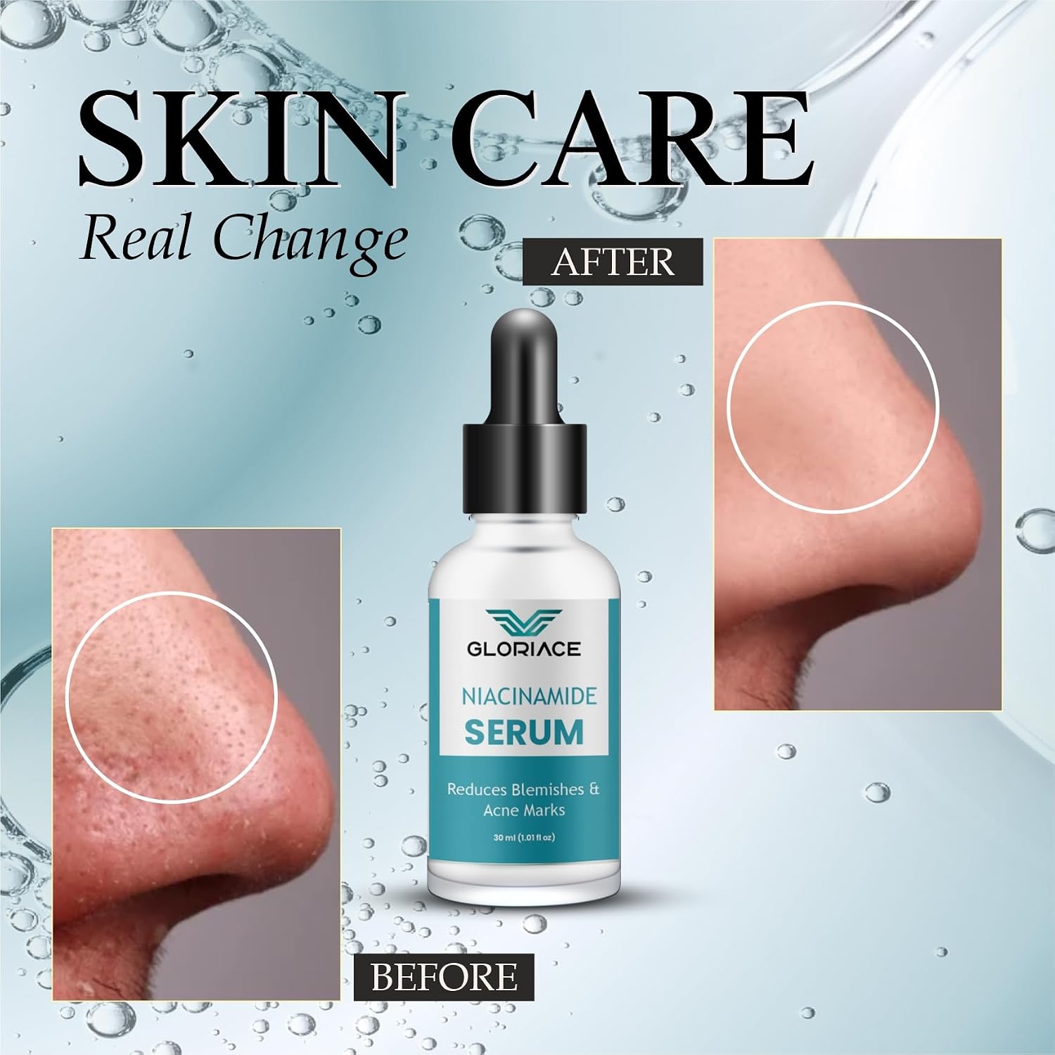 Gloriace Niacinamide Face Serum for Acne Marks, Pimples & Oily Skin | With Zinc PCD for Acne-Prone Skin | Oil Control & Spot Reduction Face Serum (30ml)