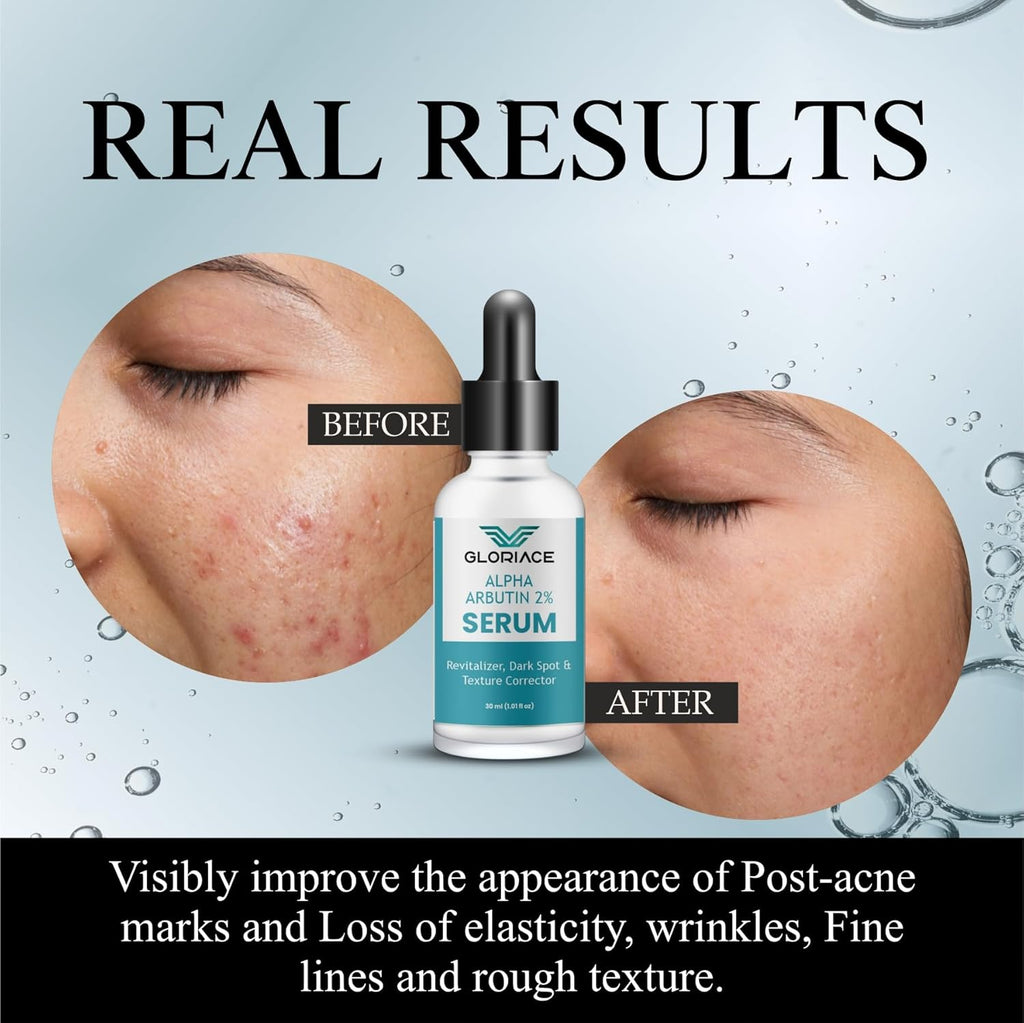 Gloriace Alpha Arbutin 2% Serum, Revitalizer, Dark Spot & Texture Corrector, 30ml
