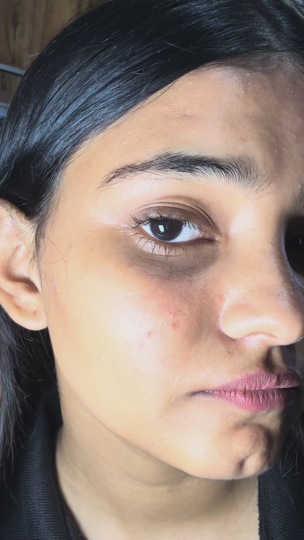 GLORIACE 2% Salicylic Acid Serum for Acne & Oily Skin